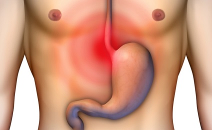 Durere, arsuri la stomac, crampe abdominale (t-clinică) Durere, arsuri la stomac, crampe abdominale