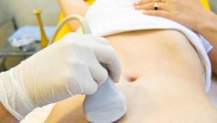 Ce este un chist ovarian hemoragic modul de a trata semnele importante (un chist) Ce este un chist ovarian hemoragic modul de a trata simptome importante