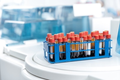 Diagnosticul, tratamentul și prevenirea bolilor ereditare (Publicarea Sănătății) Diagnosticul, tratamentul și prevenirea bolilor ereditare