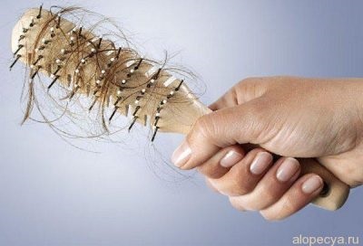 Pierderea parului este Difuze ceea ce este, cauzele și tratamentul alopeciei (difuze) Pierderea parului este Difuze ceea ce este, cauzele și tratamentul alopeciei