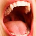 Herpes pe bărbie, cauze, simptome de tratament (foto) (motiv) Herpes pe bărbie, cauze, simptome de tratament (foto)