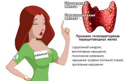 Simptomele hipocalcemiei, cauzele de hipocalcemie la copii și adulți tratați pentru hipocalcemie (simptome) Simptomele hipocalcemiei, cauzele de hipocalcemie la copii și adulți, tratamentul hipocalcemiei