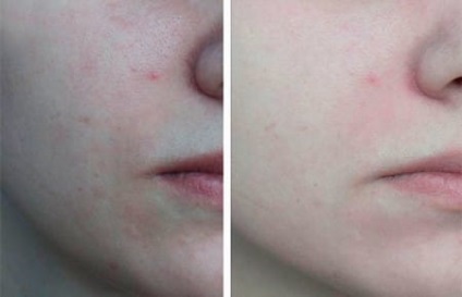 Hollywood-ul persoană de curățare la domiciliu (curatenie) Hollywood-ul de curățare facial la domiciliu