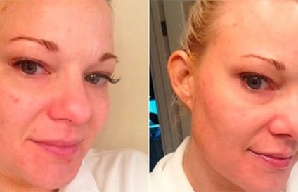 Hollywood-ul persoană de curățare la domiciliu (acasa) Hollywood-ul de curățare facial la domiciliu
