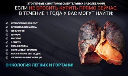 acupunctura tratament de fumat, te ajuta, argumentele pro și contra, avantaje, dezavantaje (contra) acupunctura tratament de fumat, tu, argumentele pro și contra, avantaje, dezavantaje ajuta