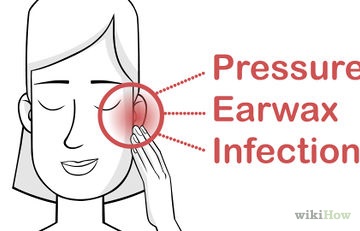 Cum de a face față cu ganglion () Cum de a face față cu ganglion