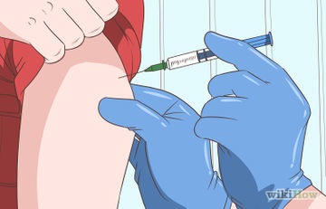 Cum de a face față cu ganglion () Cum de a face față cu ganglion