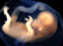 Cantitatea de lichid amniotic (număr) Cantitatea de lichid amniotic