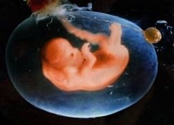 Cantitatea de lichid amniotic (număr) Cantitatea de lichid amniotic