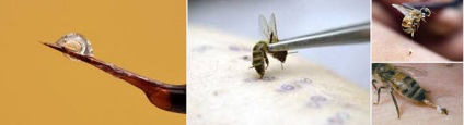 Tratamentul psoriazisului cu propolis, miere, polen și alte produse apicole (polen) Tratamentul psoriazisului cu propolis, miere, polen și alte produse apicole