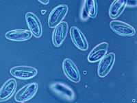 Tratamentul Leishmaniasis, simptomele, diagnosticarea, prevenirea