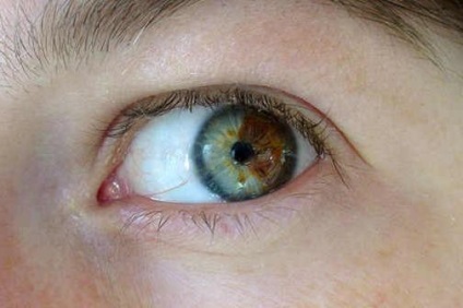 Хора с различен цвят на очите