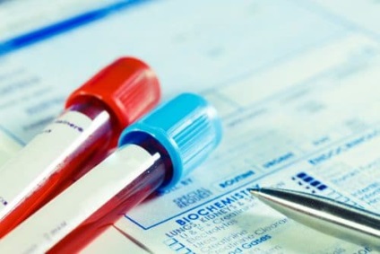 Fibroids la peretele din spate și din față a uterului, tratament nodul interstițial subseros (perete) Fibroids la peretele din spate și din față a uterului, interstițial tratament nodul subseros