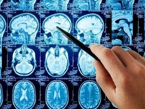 RMN in Permian - centrul de imagistica prin rezonanta magnetica - o adresă, telefon și tarife (prețuri) RMN în Permian - centrul de imagistica prin rezonanta magnetica - adresa, prețul și numărul de telefon