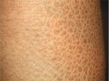 dermatologia meu (respingere intarziere corn) dermatologia mea