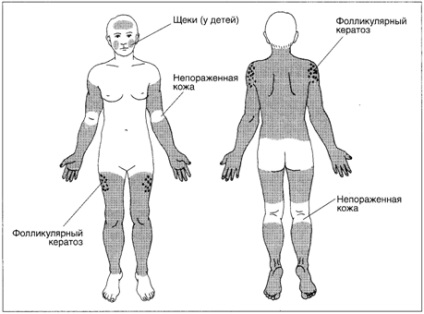 dermatologia meu (respingere intarziere corn) dermatologia mea