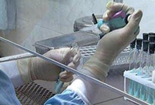 Experimente medici în prezent cele mai cunoscute cazuri în medicină (medici) Experimente medici în prezent cele mai cunoscute cazuri în medicină