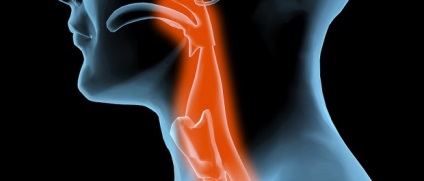 Pârli simptome ale căilor respiratorii, tratamentul (respiratorie) Burn simptomelor tractului respirator, tratament
