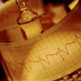 Paroxismul aritmie - tratament de inimă (tratament) Paroxismul aritmie - tratamentul inimii