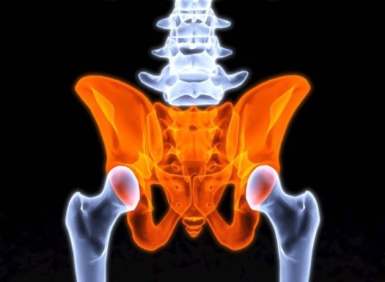 Fractura osul iliac, cauze, simptome, prim ajutor și tratament (motive) Fractura osul iliac, cauze, simptome, prim ajutor și tratament