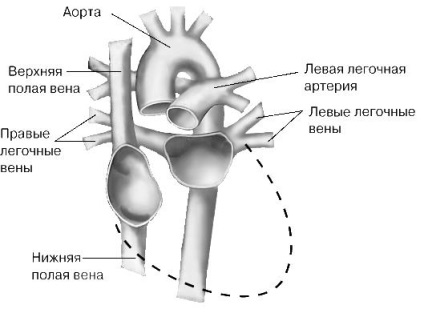 Transplantul de organe - este (antigeni de histocompatibilitate) Transplantul de organe - este