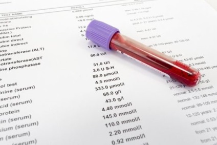 estradiol redus la femei și bărbați cauze, tratament și simptome (bărbați) Reducerea estradiol la femei și la bărbați cauze, tratament și simptome