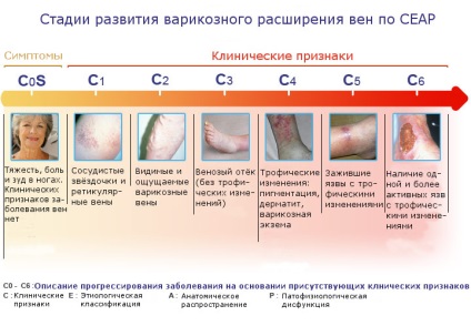 Cauzele sindromului post-trombotic, simptome și tratament (tratament) Post-trombotic cauze sindrom, simptome și tratament