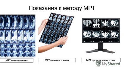 Prezentarea pe imagistica prin rezonanta magnetica (imagistica prin rezonanta magnetica. Una dintre cele mai populare metode de diagnosticare umane moderne. 40 de ani de RMN-ul a fost în măsură să dovedească.) Prezentarea pe imagistica prin rezonanta magnetica