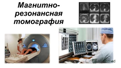 Prezentarea pe imagistica prin rezonanta magnetica (tomografie) Prezentarea pe imagistica prin rezonanta magnetica
