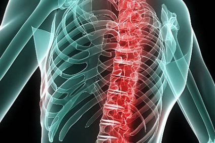 Hernia coloanei vertebrale mai bine repaus sau mișcare de recomandări pentru efort și stres (hernie) Când hernie spinării este mai bine să se odihnească sau mișcare de recomandări pentru efort și stres