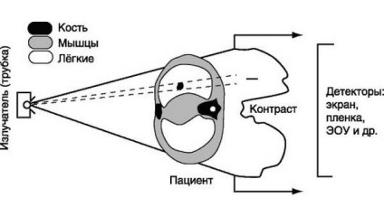 Roentgen abdominală