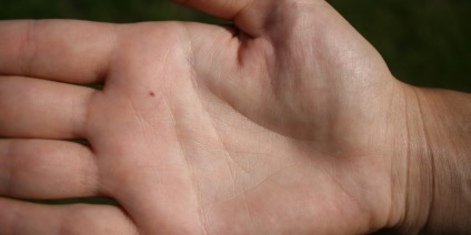 Mole pe palma dreapta și mâinile stânga și valoarea lor (mol) Mole pe palma dreapta și din stânga mâinile și semnificațiile lor