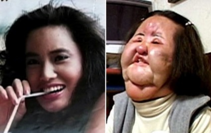 Șocând victima chirurgiei plastice (plastic) Șocând victima de chirurgie plastica