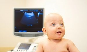 Arnold Chiari anomalie sindrom de tip 1, malformații, longevitate (sindrom) Arnold Chiari Sindromul de tip 1 anomalie, malformații, speranța de viață