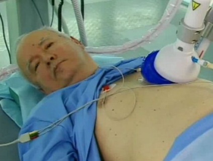 Cât de mulți trăiesc cu insuficiență cardiacă - tratament de inimă (tratament) Cât de mulți trăiesc cu insuficiență cardiacă - tratament de inima