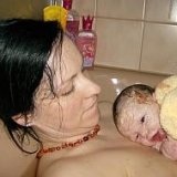 Sfaturi cum să dea naștere - bisturiu - informații medicale și portalul educațional (dreptul de consiliere pentru a da naștere) Sfaturi cu privire la modul de a da naștere dreapta - bisturiu - informații medicale și portal educațional