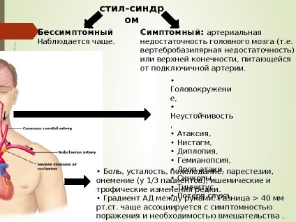 Steal- синдром колко често ще измерите