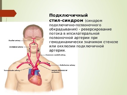 Steal- синдром колко често ще измерите