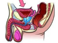 Remediile tradiționale și populare pentru a combate prostatita (prostatita) Remediile tradiționale și populare pentru a combate prostatita