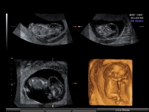 patologie fetală Uzi (fetus) Uzi patologiei fetale