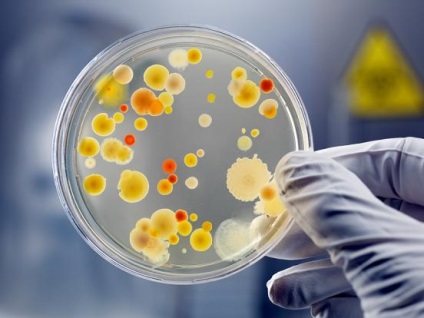 Viruși și bacterii (infecție) Viruși și bacterii