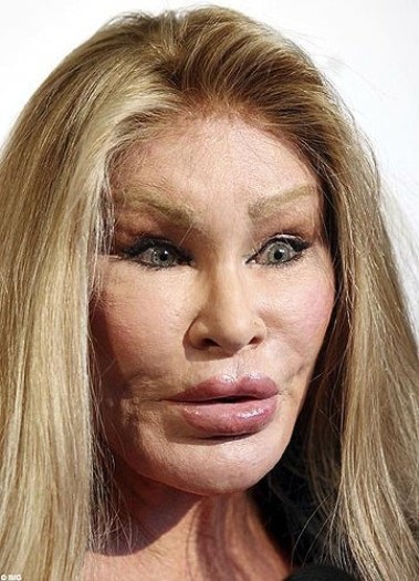 Catwoman a devenit chiar mai rau dupa chirurgie plastica (fotografii) (în vârstă de 63 de ani, Vindelshteyn întinde ca) Catwoman a devenit chiar mai rau dupa chirurgie plastica (foto)