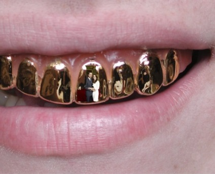 aur dentar (aur) aur dentar