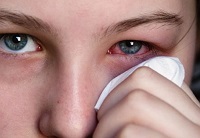 Simptomele adenovirali conjunctivita și tratament la adulți (adenovirus) Simptome conjunctivită adenoviral și tratament la adulți
