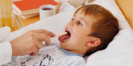 Angina catarală - simptome si tratament pentru copii și adulți (catarală dureri în gât) catarală Angina - simptome si tratament pentru copii și adulți