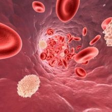 Alergia de curățare a corpului (antiparazitar) Alergia de curățare a corpului