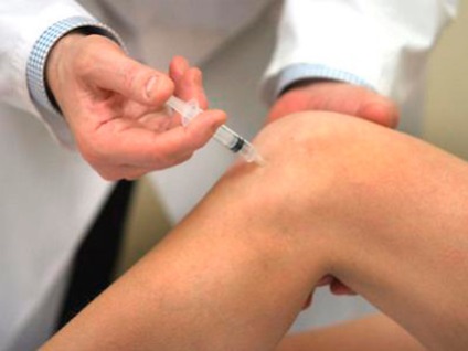 Osteoartrita a genunchiului - diagnostic și tratament (artroza articulației genunchiului) Osteoartrita a genunchiului - Diagnostic si Tratament