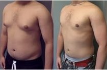 atrofie testiculară la masculi (cap sigiliul penisului) atrofie testiculară la bărbați