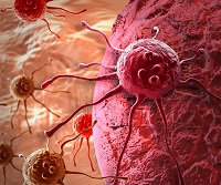 Beta-globulinele 1 și 2 crescute (crescute) Beta-globulinele 1 și 2 au crescut