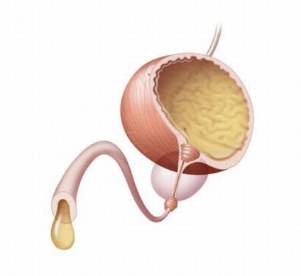 Diagnostic boli urologice (deconectat de secreție de urină) Diagnostic Urologicals